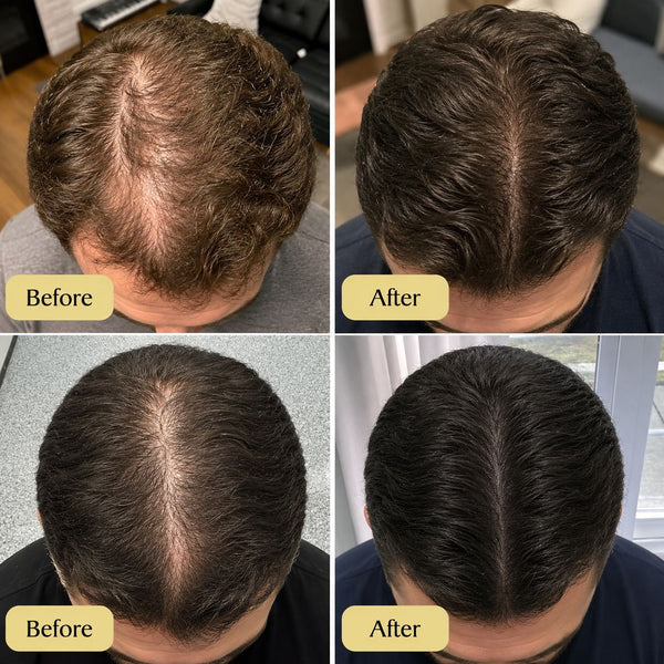 Deoxyribose Scalp Serum